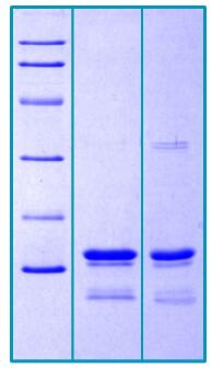 14 % SDS-PAGE separation of Rhesus Procalcitonin: <br />1. M.W. marker-14, 21, 31, 45, 66, 97 kDa <br />2. reduced and boiled sample, 2.5μg/lane <br />3. non-reduced and non-boiled sample, 2.5μg/lane